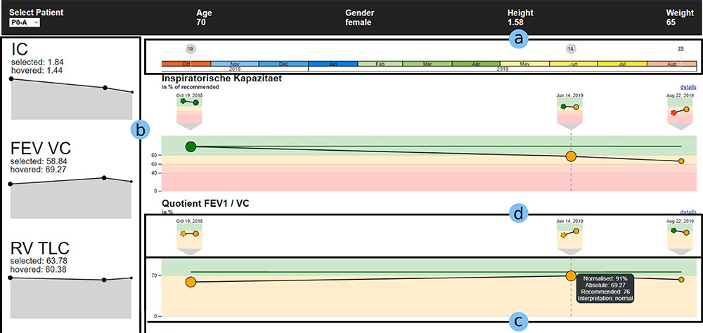Designing interactive visualizations for analyzing chronic lung diseases in a user-centered approach